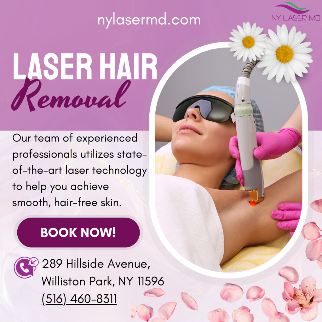 laser hair removal