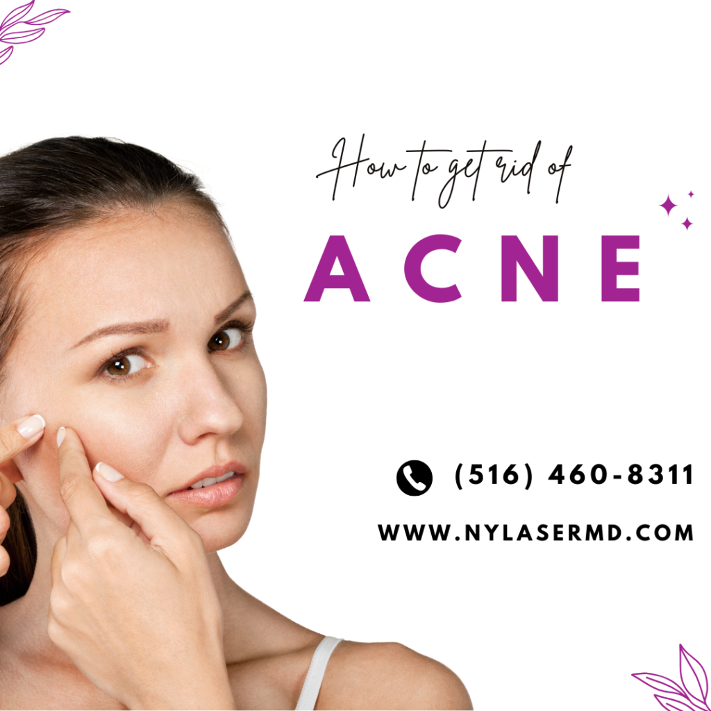 Acne Treatment