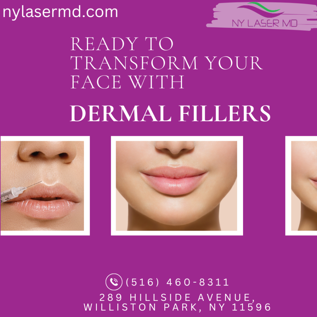 Dermal filler